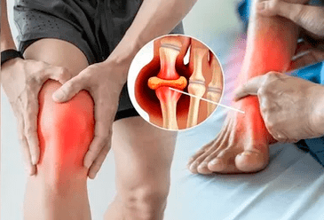 Schema zum Auftragen von Icexin-Gel auf den Knie- und Fußgelenkbereich.